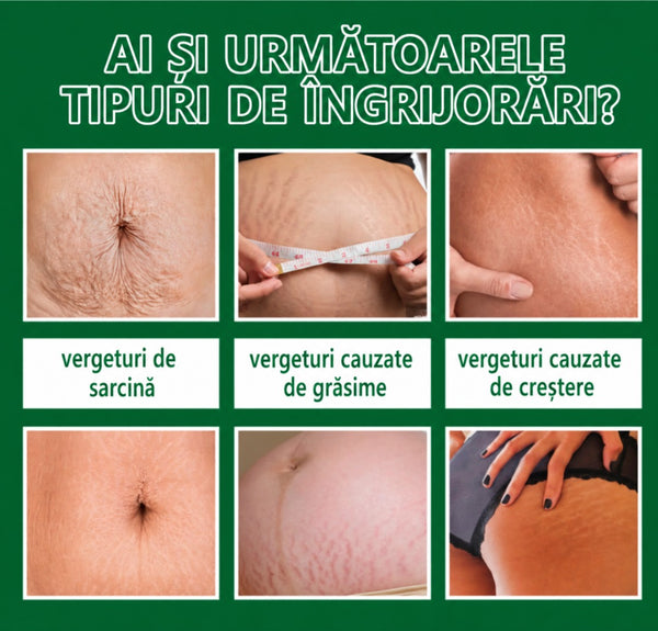 Cremă Minune pentru Cicatrici