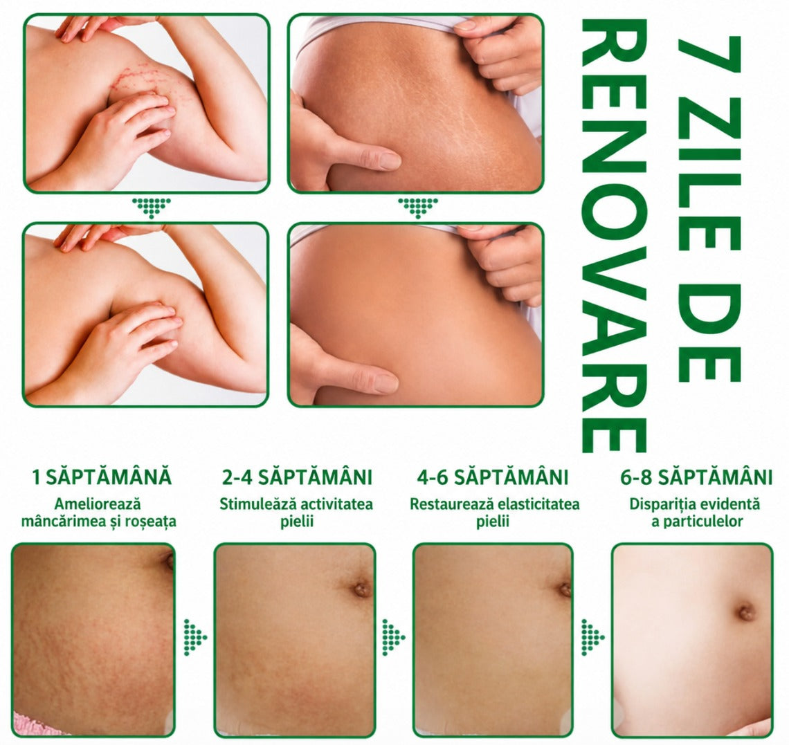 Spray naturist pentru vergeturi